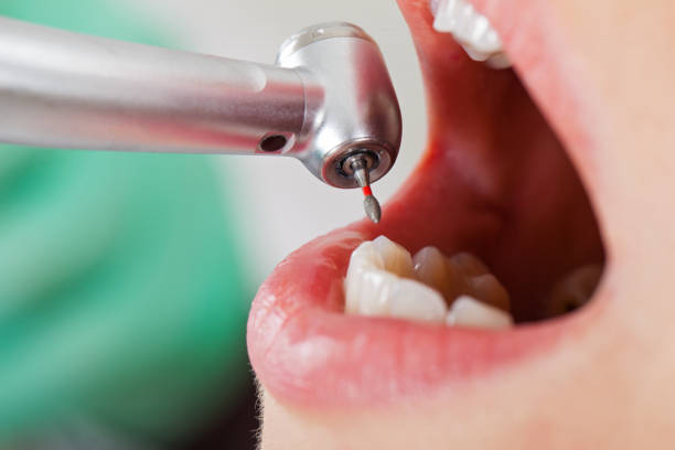 Best Dentist for Tooth Abscess  in Cowpens, SC